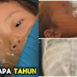 Kasus Balita Raya Asal Sukabumi