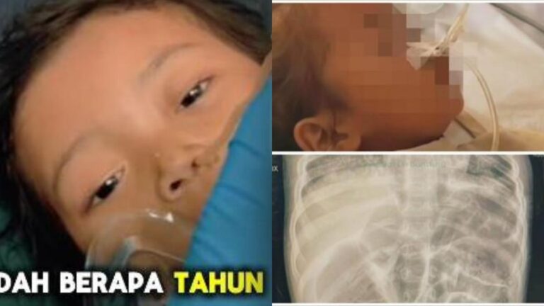 Kasus Balita Raya Asal Sukabumi